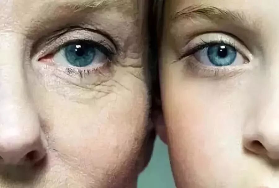 黑眼圈成因及解决方法_眼部肌肤衰老原因_孩子有黑眼圈是怎么办